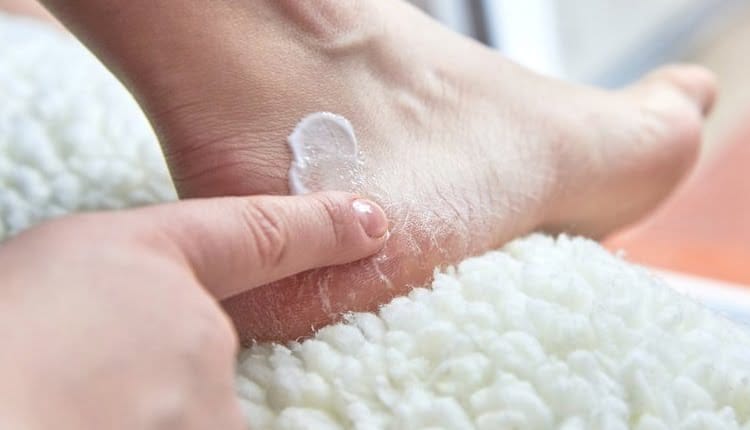 بررسی علت ترک پا و نحوه درمان آن با بهترین کرمها